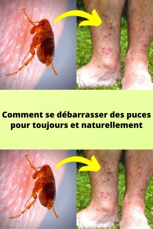 Remède naturel anti-puce textile